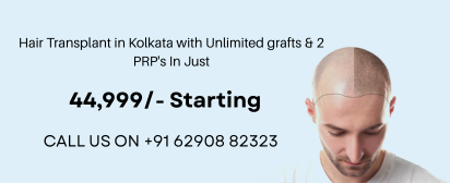 Hair Transplant Cost